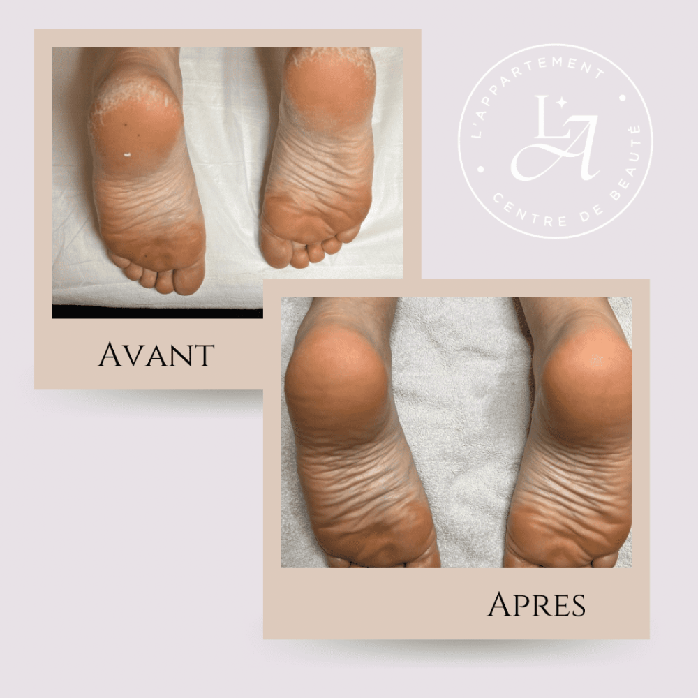 L'APPARTEMENT